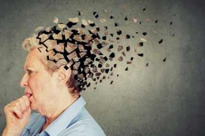 تشخیص آلزایمر از راه آزمایش خون با دقت ۹۱ درصدی ممکن می شود